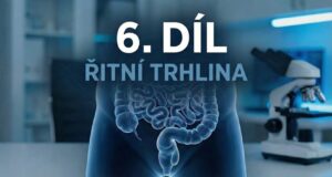 6.díl - Řitní trhlina