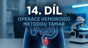 14.díl - Operace hemoroidů metodou TAMaR