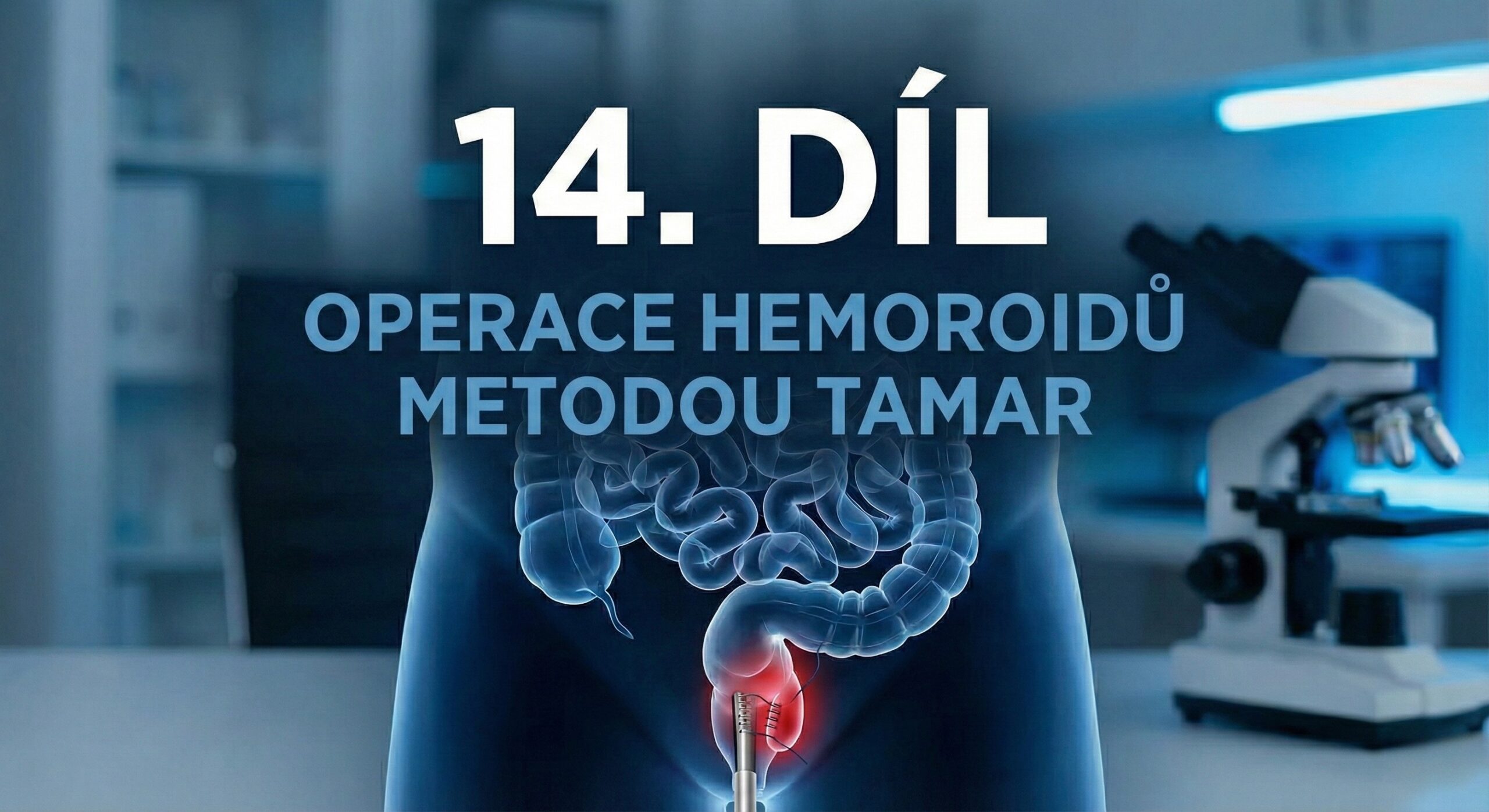14.díl - Operace hemoroidů metodou TAMaR